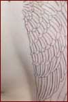 The healed left wing outline.